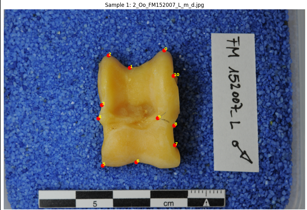 Predictive Bone Data Analysis & Modeling